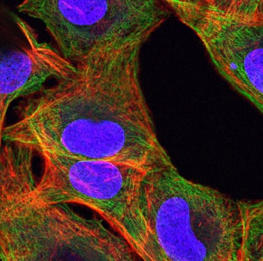 témoignages métiers marquage immunologique de cellule