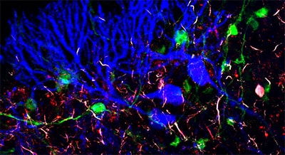 ENS métiers recherche immunohistochimie cellule de Purkinje