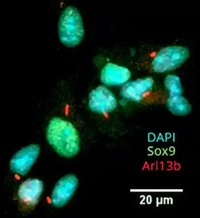 temoignage cils primaires astrocytes