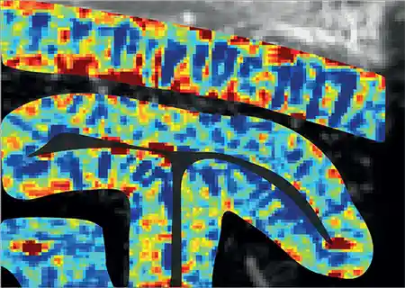 témoignage métiers cortex visuel